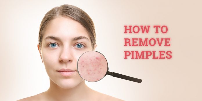 How to remove pimple marks